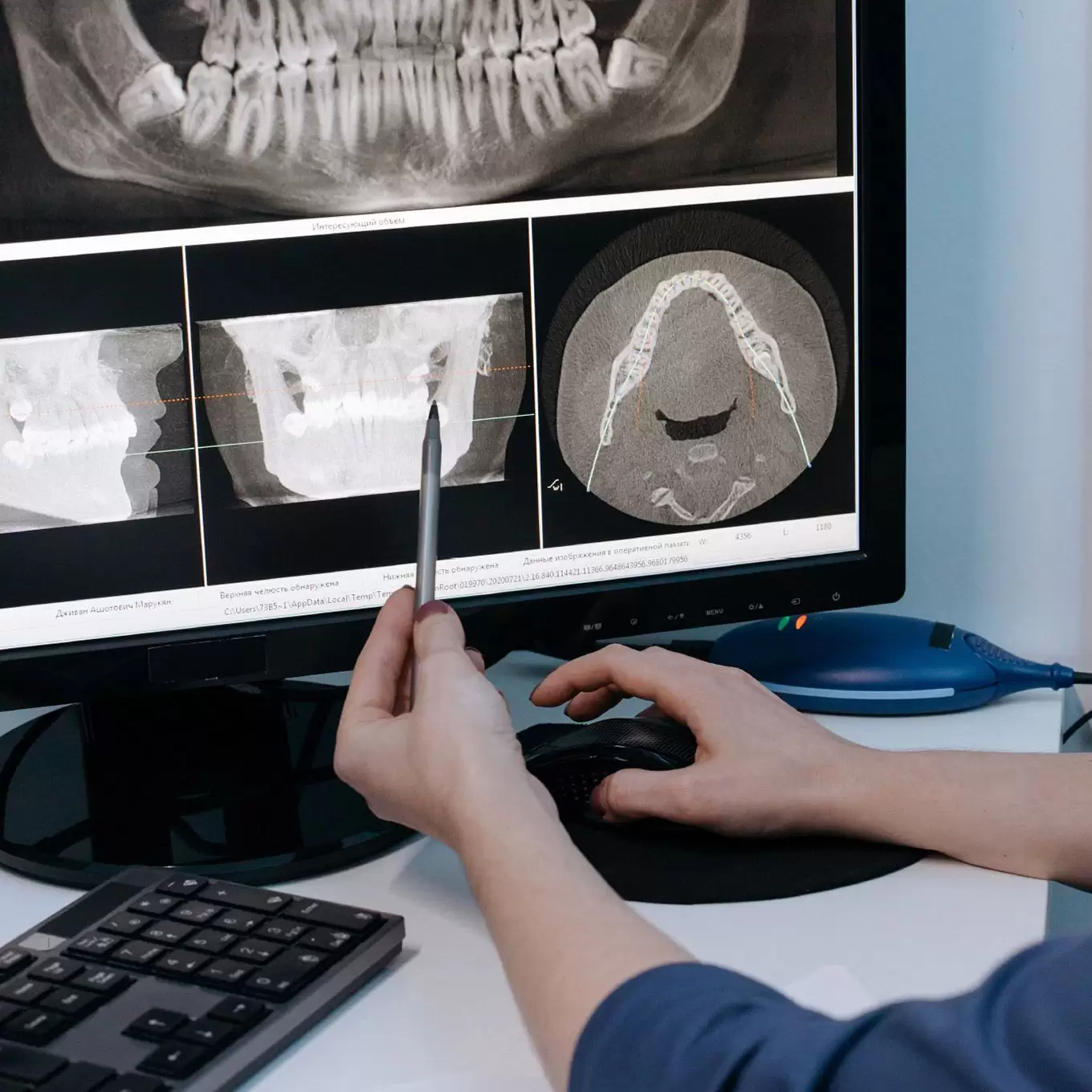 echipament radiologic
